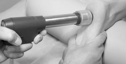 Shockwave therapie Nijmegen
